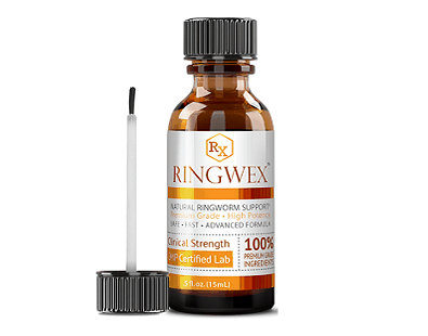 Ringwex ringworm product Review