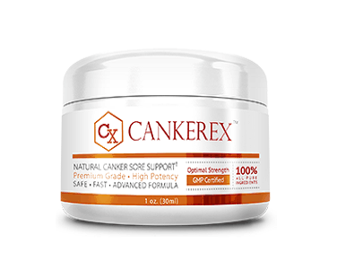Cankerex for canker sores