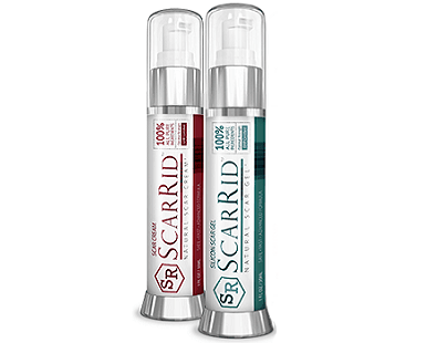 Scarrid Natural Scar Formula gel and cream