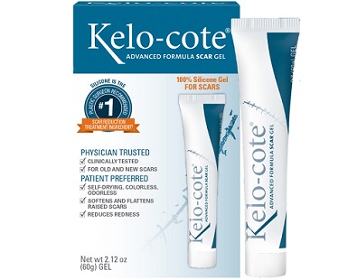 Kelo-Cote scar treatment Review
